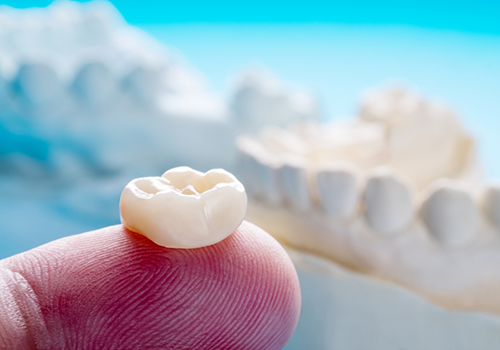 Animated dental crown being fitted over a tooth