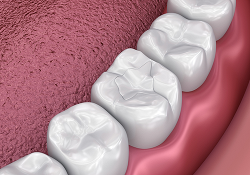 Animated row of teeth with dental sealants
