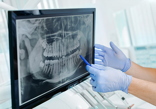 Dentist looking at computer screen with digital dental x rays